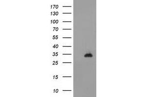 Image no. 1 for anti-CTD (Carboxy-terminal Domain, RNA Polymerase II, Polypeptide A) Small Phosphatase 1 (CTDSP1) antibody (ABIN1497680) (CTDSP1 antibody)