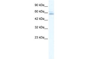 WB Suggested Anti-ZNF141 Antibody Titration:  2. (ZNF141 antibody  (N-Term))