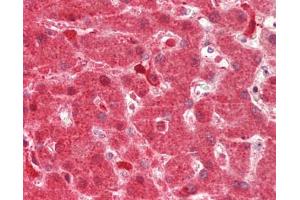 Human Liver: Formalin-Fixed, Paraffin-Embedded (FFPE). (DHODH antibody  (AA 69-118))