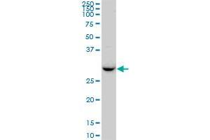 RDH13 MaxPab polyclonal antibody. (RDH13 antibody  (AA 1-260))