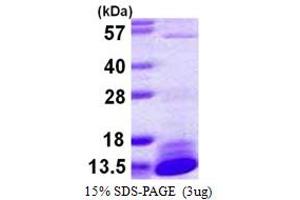 SDS-PAGE (SDS) image for Dynein, Light Chain, LC8-Type 2 (DYNLL2) (AA 1-89) protein (His tag) (ABIN667470)
