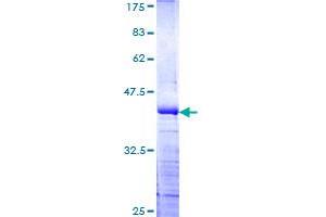 PHIP Protein (AA 1599-1705) (GST tag)