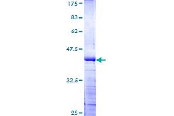 PHIP Protein (AA 1599-1705) (GST tag)