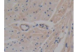 IHC-P analysis of Mouse Heart Tissue, with DAB staining. (ABCA1 antibody  (AA 1404-1663))