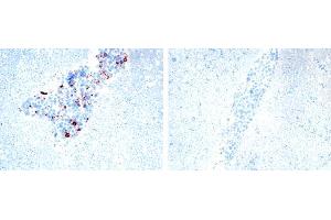 Image no. 1 for anti-Tumor Necrosis Factor (Ligand) Superfamily, Member 13 (TNFSF13) antibody (ABIN187283) (TNFSF13 antibody)