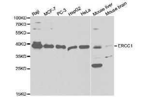 Western blot analysis of extracts of various cell lines, using ERCC1 antibody. (ERCC1 antibody  (AA 1-323))