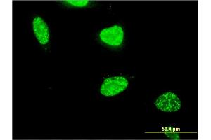 Immunofluorescence of monoclonal antibody to PAXIP1 on HeLa cell. (PAXIP1 antibody  (AA 868-975))