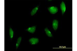 Immunofluorescence of purified MaxPab antibody to TTK on HeLa cell. (Mps1 antibody  (AA 1-857))