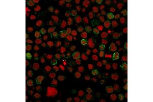 Immunofluorescence staining of paraformaldehyde-fixed Ramos cells with CD22 Mouse Monoclonal Antibody (BLCAM/1796) followed by goat anti-Mouse IgG-CF488 (Green). (CD22 antibody  (AA 52-178))
