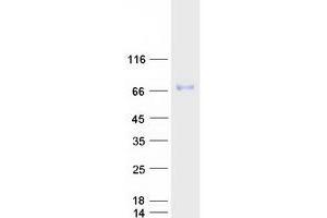 Validation with Western Blot