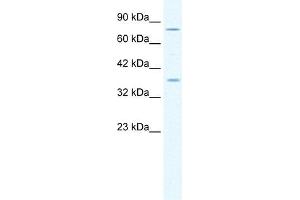 MCM4 antibody used at 1. (MCM4 antibody  (Middle Region))