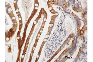 Immunostaining (ISt) image for anti-Cytochrome P450, Family 3, Subfamily A, Polypeptide 4 (CYP3A4) (AA 1-503) antibody (ABIN514838)