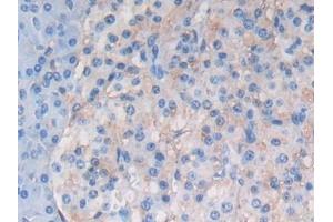 Detection of ATF6 in Human Pancreas Tissue using Polyclonal Antibody to Activating Transcription Factor 6 (ATF6) (ATF6 antibody  (AA 423-646))