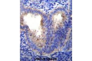 EIF5AL1 Antibody (C-term) immunohistochemistry analysis in formalin fixed and paraffin embedded human uterus tissue followed by peroxidase conjugation of the secondary antibody and DAB staining. (EIF5AL1 antibody  (C-Term))