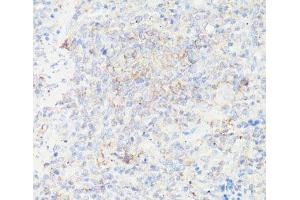 Immunohistochemistry of paraffin-embedded Rat spleen using IGFBP1 Polyclonal Antibody at dilution of 1:100 (40x lens). (IGFBPI antibody)