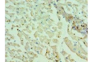 Immunohistochemistry of paraffin-embedded human heart tissue using ABIN7160559 at dilution of 1:100 (MYH1 antibody  (AA 1-100))