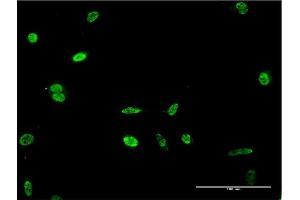 Immunofluorescence of monoclonal antibody to HES2 on HeLa cell. (HES2 antibody  (AA 41-114))