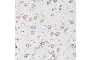 Immunohistochemistry of paraffin-embedded rat brain using CYLD Rabbit pAb (ABIN1679467, ABIN3018138, ABIN3018139 and ABIN6220378) at dilution of 1:100 (40x lens). (CYLD antibody  (AA 654-953))