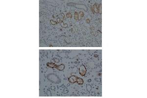 Sample Type:  Human Kidney   Dilution:  1:100 (CYP1A1 antibody  (Middle Region))