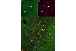 Expression of Adenosine A1 Receptor in rat medial septumImmunohistochemical staining of rat medial septum frozen section using Anti-Adenosine A1 Receptor Antibody (ABIN7042882, ABIN7043894 and ABIN7043895). (Adenosine A1 Receptor (ADORA1) Peptide)