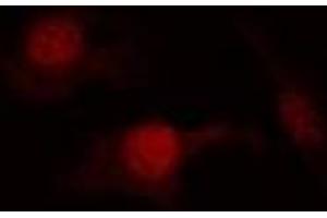 Immunofluorescent analysis of PTEN (pS380/T382/T383) staining in Hela cells.