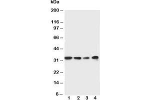 Western blot testing of MyD88 antibody and Lane 1:  rat spleen;  2: rat thymus;  3: Jurkat;  4: Raji cell lysate.