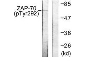 Western blot analysis of extracts from Jurkat cells treated with UV 15', using ZAP-70 (Phospho-Tyr292) Antibody. (ZAP70 antibody  (pTyr292))