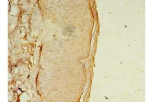 Immunohistochemistry of paraffin-embedded human skin tissue using ABIN7165891 at dilution of 1:100 (OSR2 antibody  (AA 101-276))