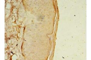 Immunohistochemistry of paraffin-embedded human skin tissue using ABIN7165891 at dilution of 1:100