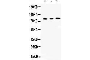 Western blot analysis of Cyclin T1 expression in rat kidney extract ( Lane 1), mouse spleen extract ( Lane 2) and JURKAT whole cell lysates ( Lane 3). (Cyclin T1 antibody  (Middle Region))
