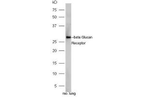 Mouse lung lysates probed with Rabbit Anti-Beta Glucan Receptor Polyclonal Antibody, Unconjugated  at 1:5000 for 90 min at 37˚C. (CLEC7A antibody  (AA 41-140))
