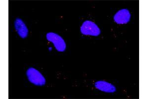 Proximity Ligation Analysis of protein-protein interactions between MAPK3 and DAPK1. (DAP Kinase 1 antibody  (AA 1211-1310))