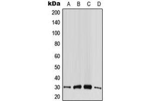 Western blot analysis of CABP4 expression in HeLa (A), HepG2 (B), SP2/0 (C), PC12 (D) whole cell lysates. (CABP4 antibody  (Center))