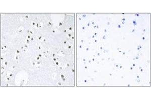 Immunohistochemistry analysis of paraffin-embedded human brain tissue, using c-Jun (Ab-243) Antibody. (C-JUN antibody  (AA 210-259))
