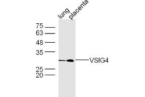 Mouse lung and placenta lysates probed with VSIG4 Polyclonal Antibody, unconjugated  at 1:300 overnight at 4°C followed by a conjugated secondary antibody at 1:10000 for 90 minutes at 37°C.