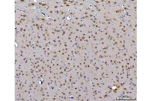 IHC analysis of CEP250 using anti-CEP250 antibody (ABIN7602053). (CEP250 antibody  (AA 563-853))