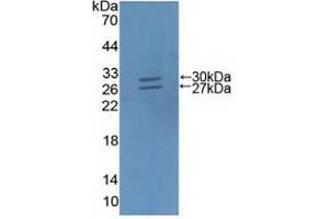 Figure. (ABCG5 antibody  (AA 66-276))