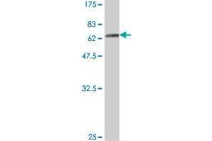 Western Blot detection against Immunogen (64. (ABHD5 antibody  (AA 1-349))
