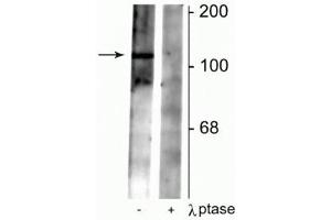 Western blot of rat synaptic membrane lysate showing specific immunolabeling of the ~102 kDa GABAB R2 protein phosphorylated at Ser783 in the first lane (-). (GABBR2 antibody  (pSer783))