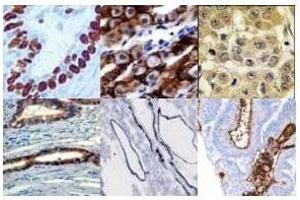 Immunohistochemistry Protein Blocker is the best first choice for blocking paraffin fixed or frozen sectioned tissues specimens for immunohistochemical staining for immunoenzymatic signal processing.