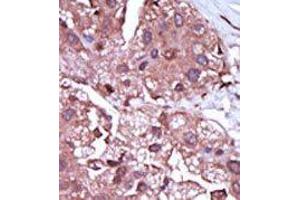 Image no. 2 for anti-Activin A Receptor Type II-Like 1 (ACVRL1) (C-Term) antibody (ABIN360125)