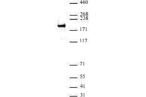 ZEB1 antibody (pAb) tested by Western blot. (ZEB1 antibody  (N-Term))