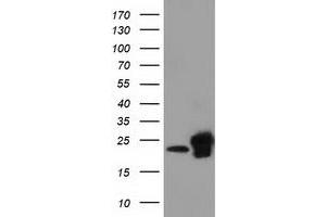 HEK293T cells were transfected with the pCMV6-ENTRY control (Left lane) or pCMV6-ENTRY SSSCA1 (Right lane) cDNA for 48 hrs and lysed. (SSSCA1 antibody)