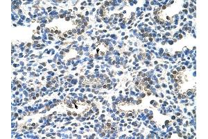 EIF2S1 antibody was used for immunohistochemistry at a concentration of 4-8 ug/ml to stain Alveolar cells (arrows) in Human Lung. (EIF2S1 antibody  (C-Term))