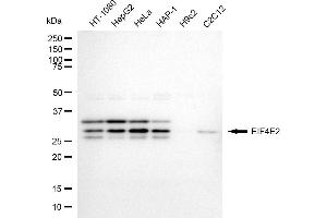 Western blotting analysis using EIF4E2 antibody (ABIN7798533). (EIF4E2 antibody)