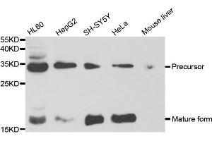 Western blot analysis of extracts of various cell lines, using NGF antibody. (Nerve Growth Factor antibody  (AA 19-241))