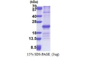 SDS-PAGE (SDS) image for Zinc Finger, HIT-Type Containing 3 (ZNHIT3) (AA 1-155) protein (His tag) (ABIN5853239) (ZNHIT3 Protein (AA 1-155) (His tag))