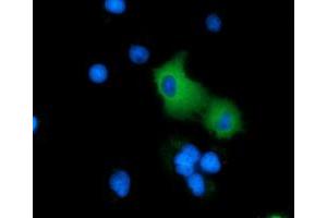 Anti-ARHGAP25 mouse monoclonal antibody (ABIN2452774) immunofluorescent staining of COS7 cells transiently transfected by pCMV6-ENTRY ARHGAP25 (RC217414). (ARHGAP25 antibody)