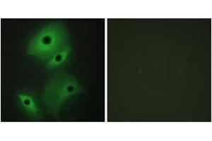 Immunofluorescence analysis of HeLa cells, using NBL1 Antibody.