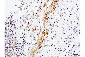 Formalin-fixed and paraffin-embedded rat skin tissue labeled with Anti-Collagen V Polyclonal Antibody, Unconjugated  1:200 followed by conjugation to the secondary antibody and DAB staining (Collagen Type V antibody  (AA 1450-1500))